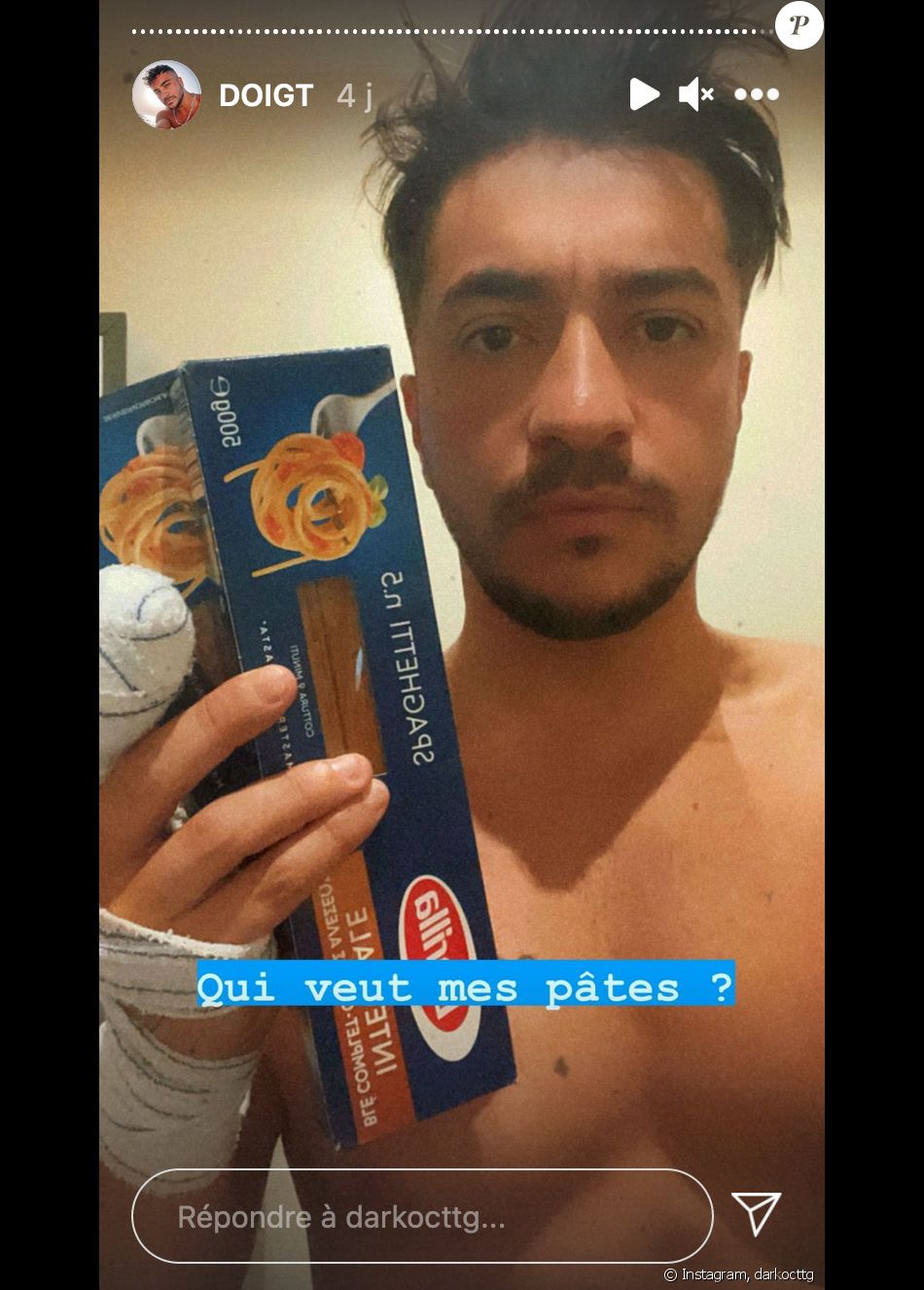 Darko (Secret Story) obligé de se faire hospitaliser après s'être coincé un morceau de pate dans l'ongle d'un doigt - Instagram