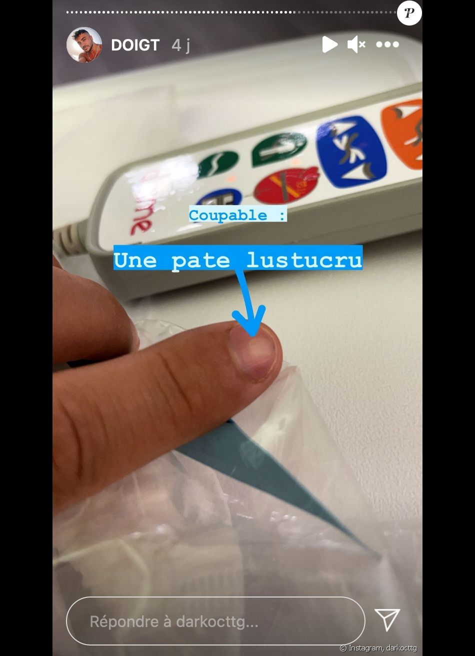 Darko (Secret Story) obligé de se faire hospitaliser après s'être coincé un morceau de pate dans l'ongle d'un doigt - Instagram