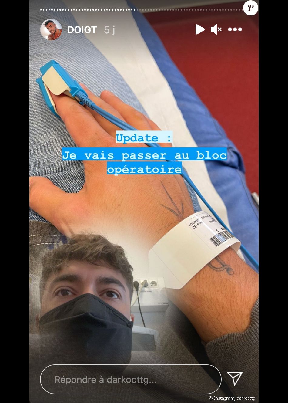 Darko (Secret Story) obligé de se faire hospitaliser après s'être coincé un morceau de pate dans l'ongle d'un doigt - Instagram