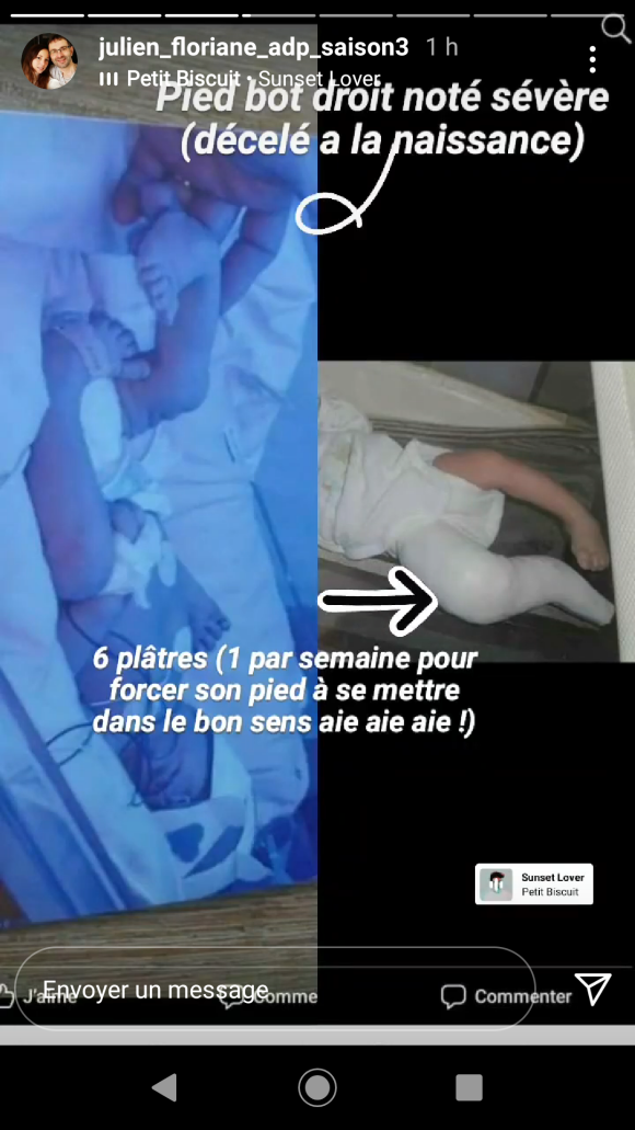 Floriane, la femme de Julien de "L'amour est dans le pré" explique la pathologie de Lina en story Instagram, le 3 juin 2021