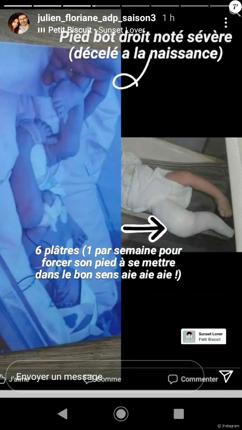 Floriane, la femme de Julien de "L'amour est dans le pré" explique la pathologie de Lina en story Instagram, le 3 juin 2021