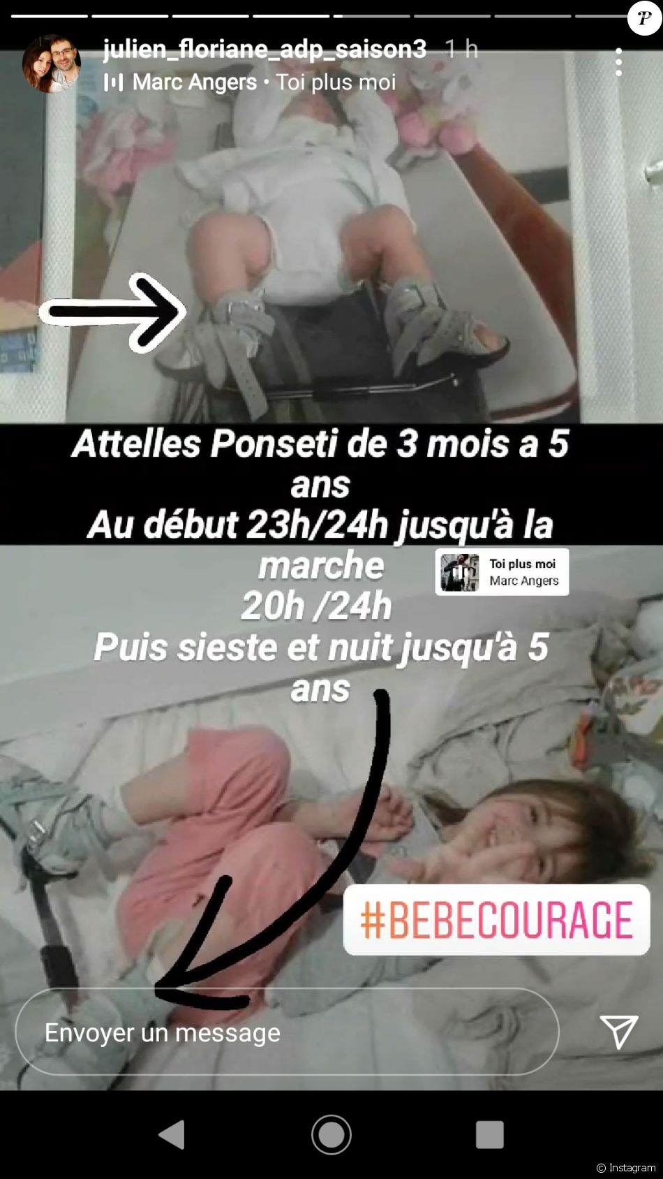 Floriane, la femme de Julien de "L'amour est dans le pré" explique la pathologie de Lina en story Instagram, le 3 juin 2021