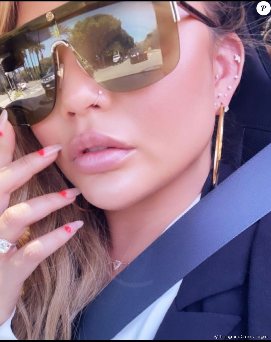 Chrissy Teigen Nouvelle opération de chirurgie esthétique, elle