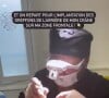 Hugo Philip partage son opération de greffe capillaire sur Instagram.