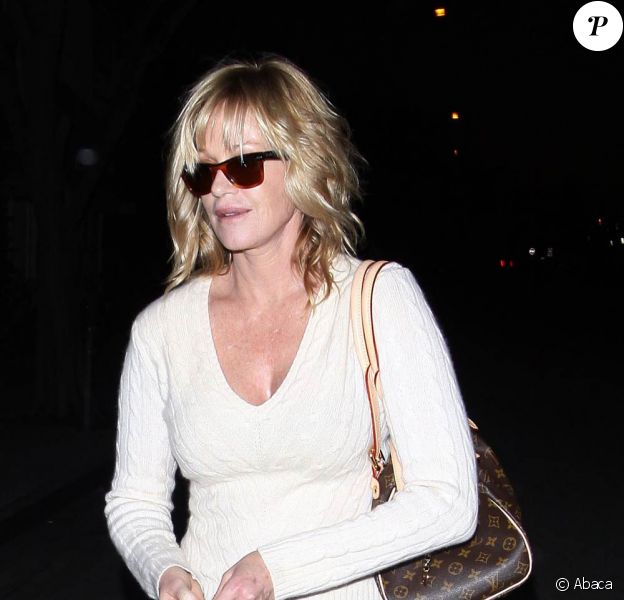 Melanie Griffith Elle Nous Cache Un Vilain Oeil Au Beurre