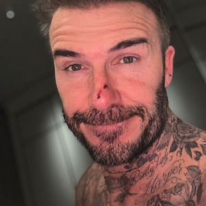 David Beckham a publié un selfie dans sa story Instagram du 29 novembre 2021, pour montrer sa blessure au nez.