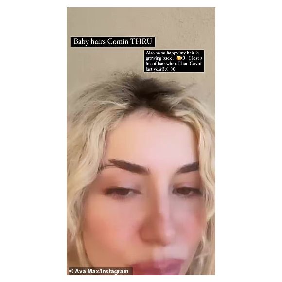 Ava Max explique qu'elle a perdu beaucoup de cheveux à cause de la Covid-19. Le 29 décembre 2021.