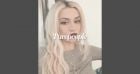 Ava Max terrassée par la Covid-19, elle en perd ses cheveux !
