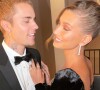 Hailey Bieber, jolie frayeur à l'hôpital : caillot dans le cerveau et symptômes inquiétants