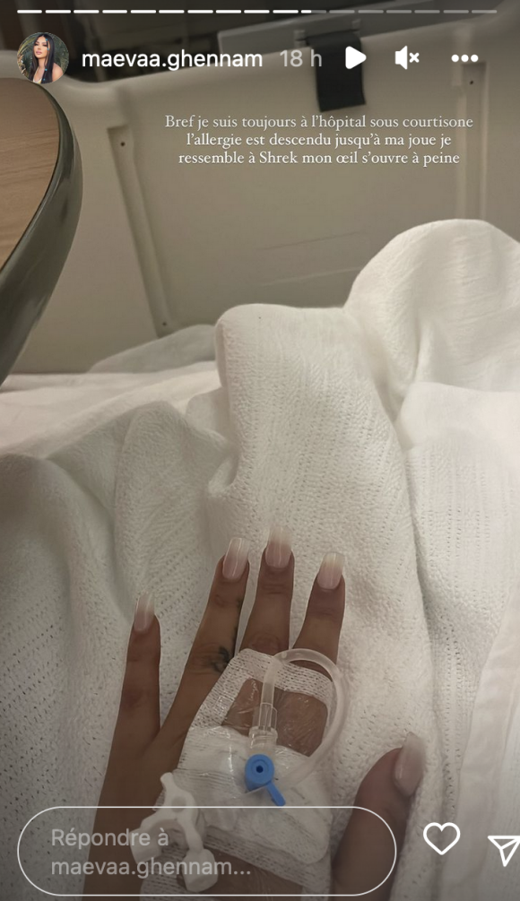 Maeva Ghennam a révélé se trouver à l'hôpital à cause d'une forte allergie - Instagram