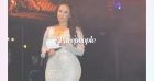 Milla Jasmine succombe encore la chirurgie esthétique : gros changement sur son visage !