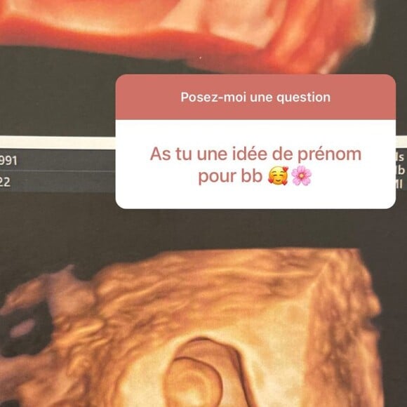 Capucine Anav a fait de grandes révélations sur le sexe et le prénm de son futur bébé @ Instagram / Capucine Anav