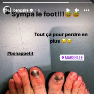 Benoît Paire dévoile ses pieds cabossés sur Instagram, le 13 décembre 2022.