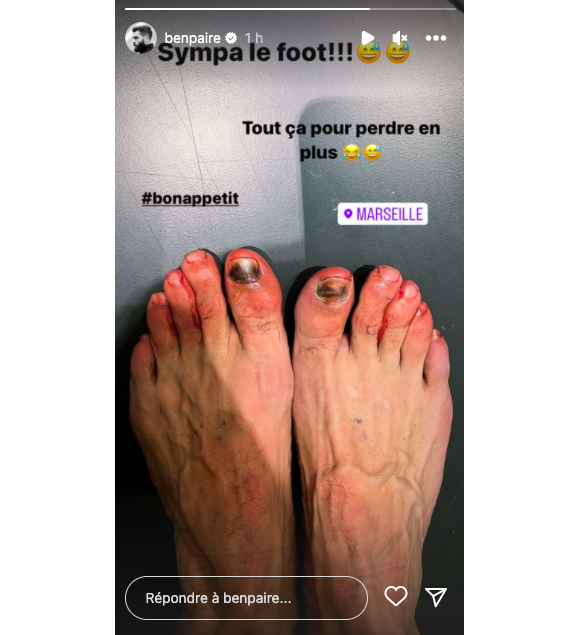 Benoît Paire dévoile ses pieds cabossés sur Instagram, le 13 décembre 2022.