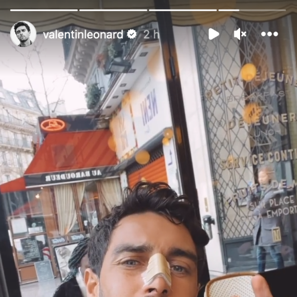 Valentin Léonard révèle avoir subi une opération et se dévoile avec un pansement au nez - Instagram