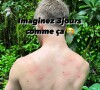 Michou dévoile son dos parsemé de piqures de moustiques - Instagram