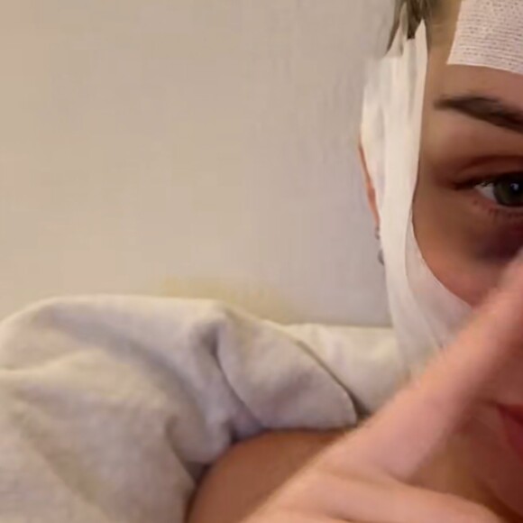 Jessica Thivenin se dévoile après sa nouvelle opération de chirurgie esthétique, le 9 février 2023