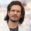 François Civil aveugle pendant 36h, pied cassé... tournage catastrophe pour Les Trois Mousquetaires !
