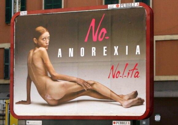Isabelle Caro a posé en 2007 pour la campagne No Anorexia