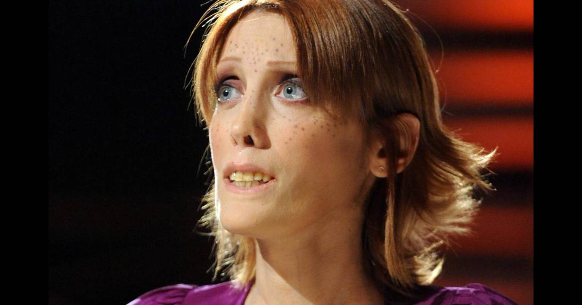 La Belle De Jérusalem émission De Télévision Isabelle Caro : Regardez le mannequin anorexique qui avait choqué l