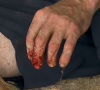 Et s'est coupé le doigt avec une machette.
Douzième épisode de "Koh-Lanta, Les Chasseurs d'immunité", mardi sur TF1.