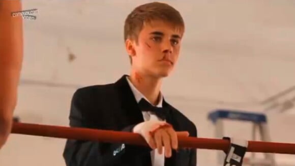 Justin Bieber, en sang, esquinté par un boxeur