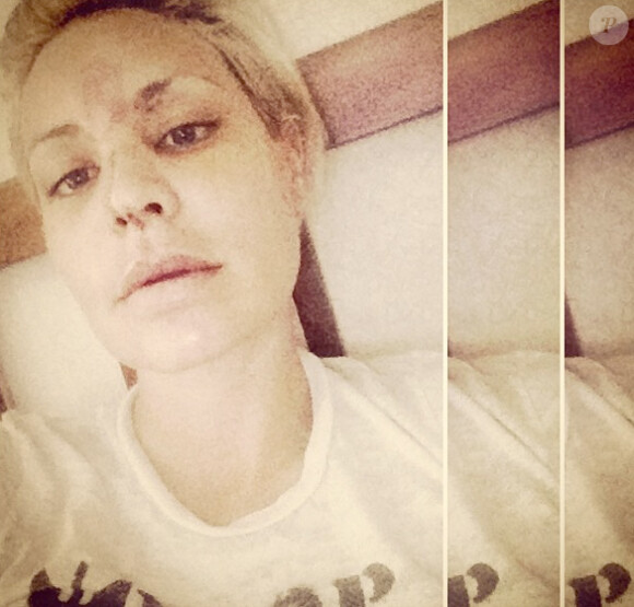 Lisa D'Amato a partagé des photos de son visage tuméfié jeudi 24 janvier sur Instagram après une très mauvaise chute.