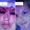 Lisa D'Amato a posté, jeudi 24 janvier 2013, des photos d'elle défigurée par une mauvaise chute.