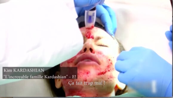 Kim Kardashian s'essaye au blood lifting (le lifting du vampire) dans sa télé-réalité Les Soeurs Kardashian à Miami