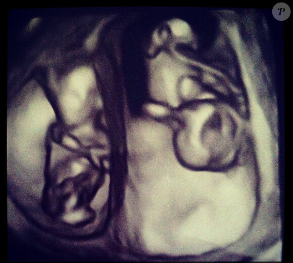 Dania Ramirez a annoncé être enceinte de jumeaux. Juillet 2013.
