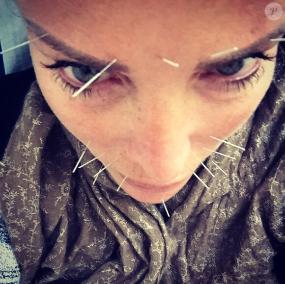 Ophélie Winter en pleine séance d'acupuncture, le 1er octobre 2014.