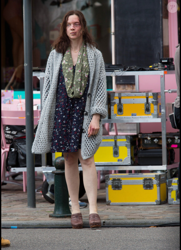 Exclusif - L'actrice Odile Vuillemin, défigurée sur le tournage du téléfilm L'Emprise de Claude-Michel Rome avec Marc Lavoine, à Bruxelles en Belgique le 1er septembre 2014.