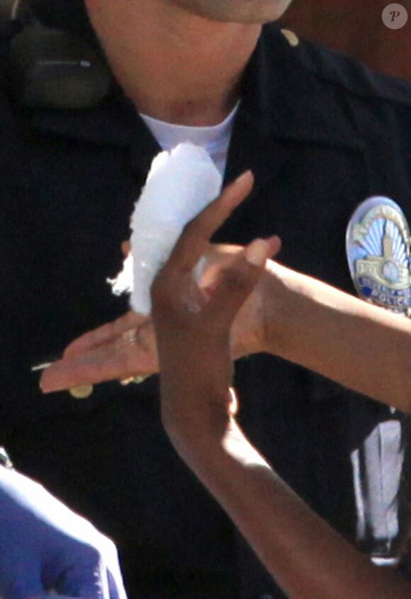 La photographe bandée au majeur gauche après son altercation avec Suge Knight et son entourage. Beverly Hills, le 5 septembre 2014.