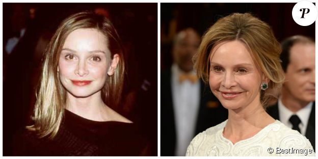 Calista Flockhart en 1999 et 2014 - ©BESTIMAGE