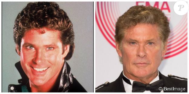 David Hasselhoff en 1987 et en 2014 - ©BESTIMAGE