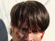 Mads Mikkelsen en sang et le visage tuméfié : Hannibal comme on ne l'a jamais vu
