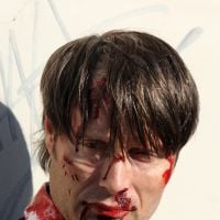Mads Mikkelsen en sang et le visage tuméfié : Hannibal comme on ne l'a jamais vu