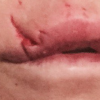 Jillian Barberie s'est fait mordre par le chien d'un ami. Elle a publié une photo de sa blessure à la lèvre sur sa page Twitter, le 13 mars 2016.