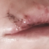 Jillian Barberie s'est fait mordre par le chien d'un ami. Elle a publié une photo de ses dix points de suture à la lèvre qui commence à cicatriser sur sa page Twitter, le 14 mars 2016.