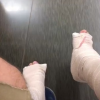 Steve-O, le célèbre Jackass, s'est cassé les deux jambes après avoir tenté une périlleuse cascade. Photo publiée sur son compte Snapchat à la fin du mois d'août 2016