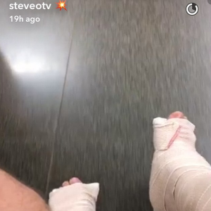Steve-O, le célèbre Jackass, s'est cassé les deux jambes après avoir tenté une périlleuse cascade. Photo publiée sur son compte Snapchat à la fin du mois d'août 2016