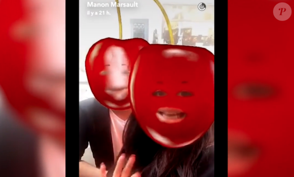 Manon Marsault marquée par le Botox : "On dirait que j'ai fait de la boxe". Octobre 2016.