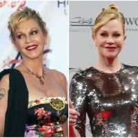 Melanie Griffith regrette la chirurgie esthétique : "Je n'avais rien remarqué"