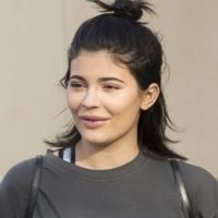 Kylie Jenner : Lèvres gonflées et traits déformés, ses excès brillent au naturel