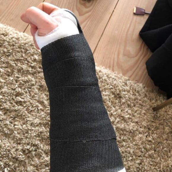 Ed Sheeran, plâtre suite à un accident à vélo, annonce l'annulation de plusieurs concerts. Instagram, le 17 octobre 2017.