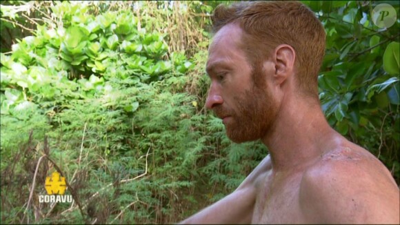 Maxime (Koh-Lanta Fidji) révèle l'origine de sa cicatrice sur l'épaule droite. L'aventurier a failli perdre l'usage de son bras droit à la suite d'un grave accident de ski, survenu en 2007.
