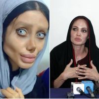 Angelina Jolie : Une fan subit 50 opérations de chirurgie pour lui ressembler
