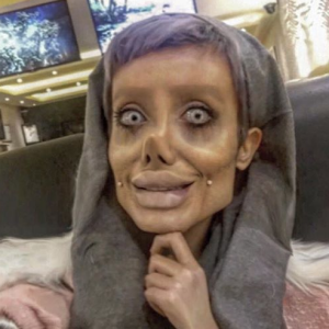 Sahar Tabar, une jeune fan iranienne, fait tout pour ressembler à Angelina Jolie. Selon la presse, elle aurait subi jusqu'à 50 opérations de chirurgie esthétique. (novembre 2017)