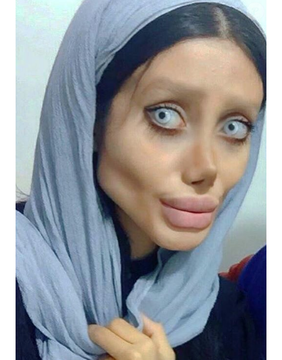 Sahar Tabar, une jeune fan iranienne, fait tout pour ressembler à Angelina Jolie. Selon la presse, elle aurait subi jusqu'à 50 opérations de chirurgie esthétique. (novembre 2017)