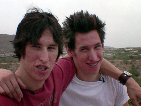 Avant la chirurgie esthétique. Matt et Mike Schlepp, des jumeaux originaires d'Arizona, ont dépensé 20 000 dollars en 2004 pour tenter de ressembler à leur idole, Brad Pitt. Les deux frères avaient participé à l'époque à l'émission de télé-réalité "I Want a Famous Face" sur MTV.
